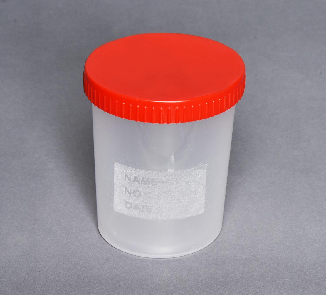 Numune Kabı 200 ml